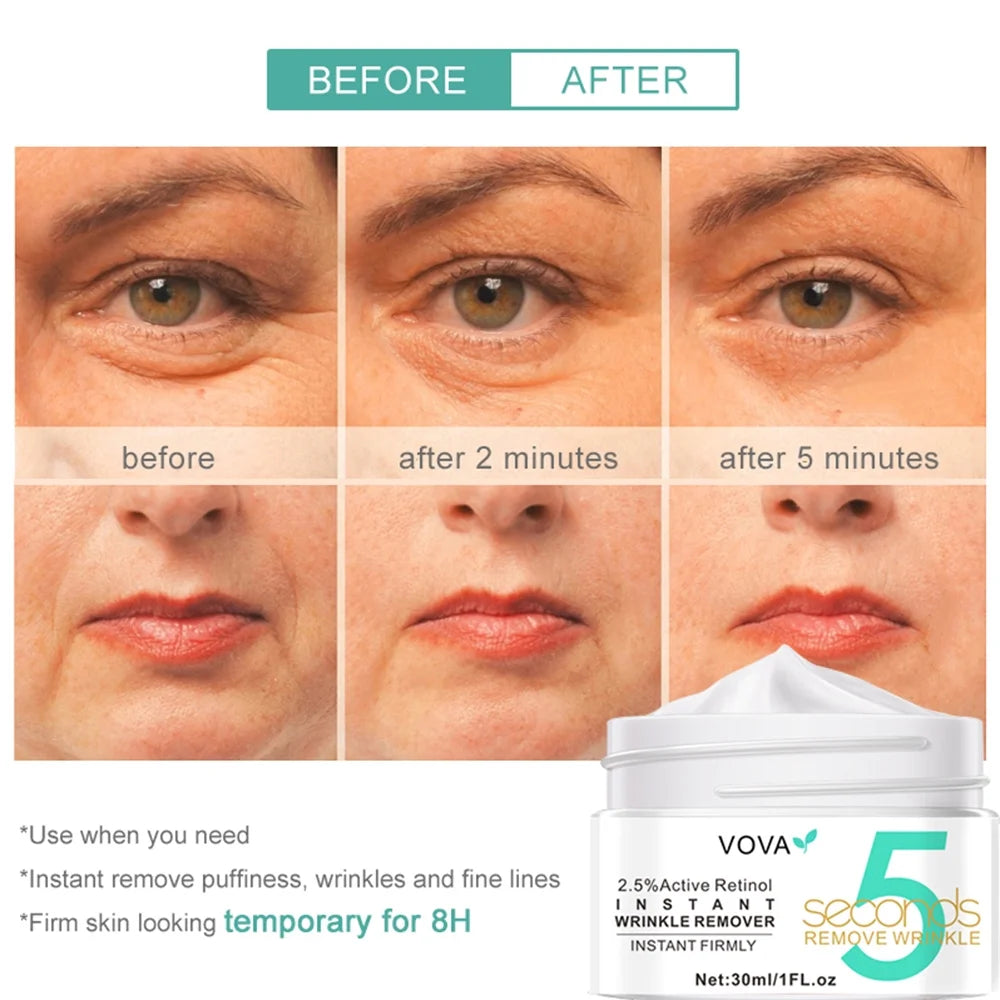 Eye Creams for Anti-Aging - 5 Seconds Instant Effect, anti Aging Fade Wrinkle Fast Absorption Expertise Wrinkle Remover Cream Face Essence Cream, 1Oz